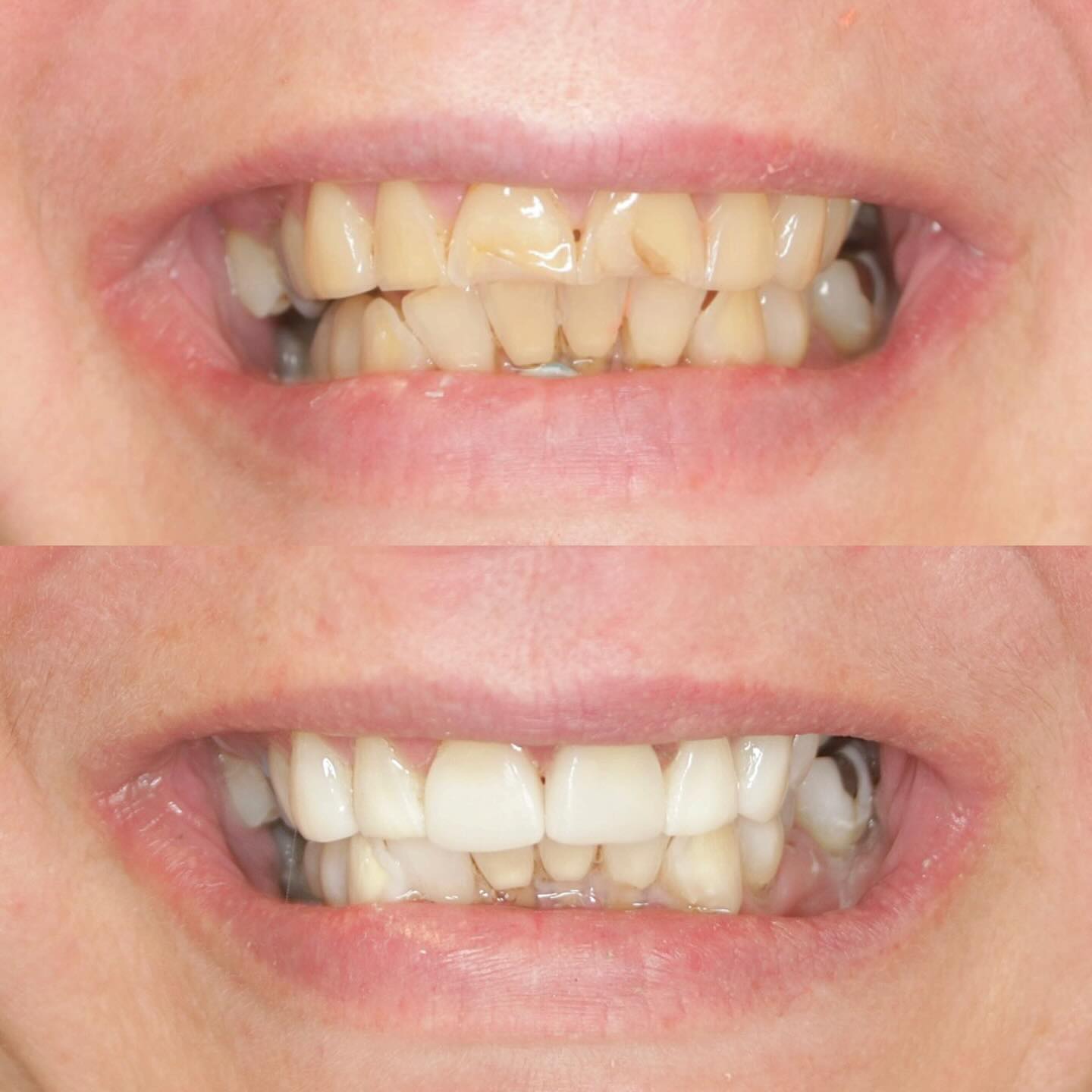 Before and After