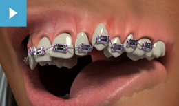 Orthodontics